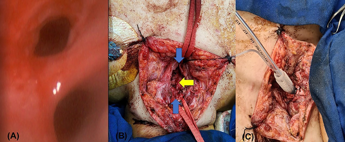 Figure 1 Refer to the following caption and surrounding text.