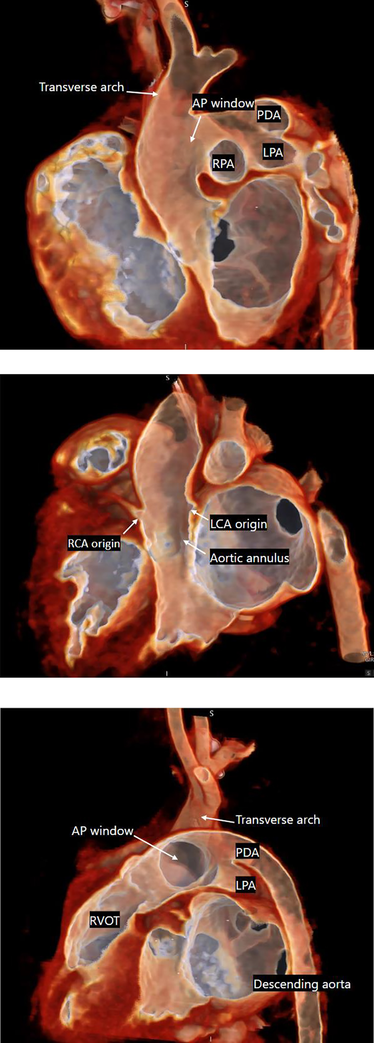 Figure 2 Refer to the following caption and surrounding text.