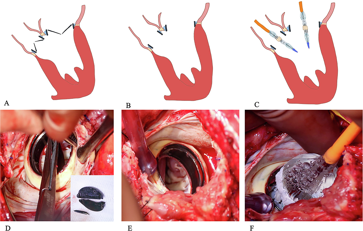 Figure 1 Refer to the following caption and surrounding text.