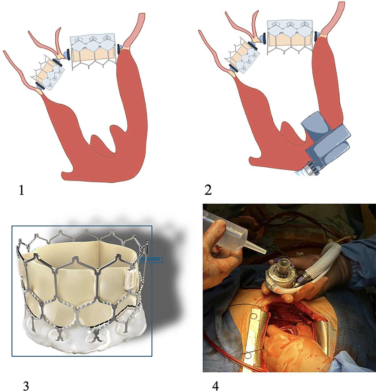 Figure 2 Refer to the following caption and surrounding text.