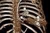 Thumbnail: Figure 3 Refer to the following caption and surrounding text.