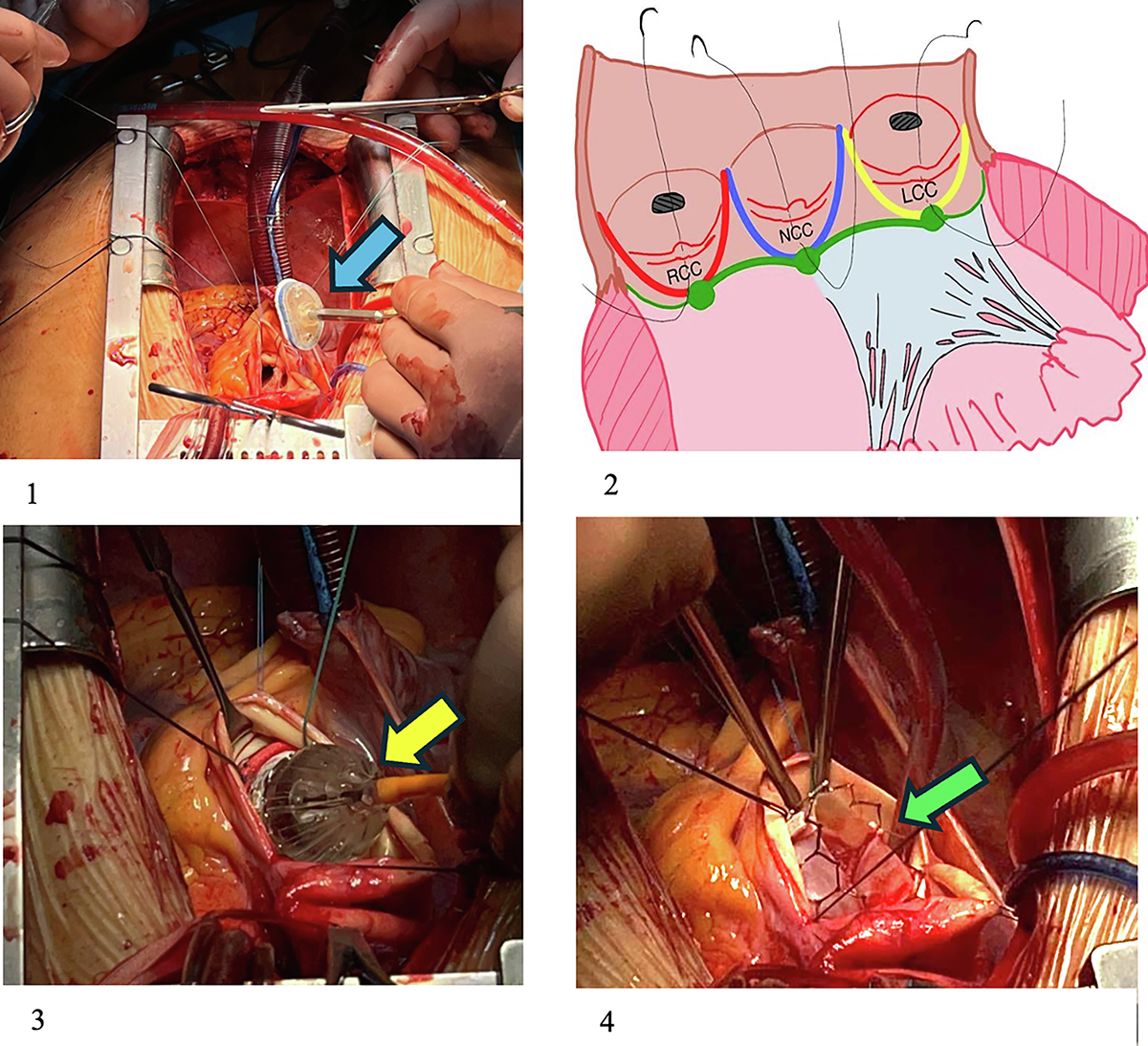 Figure 4 Refer to the following caption and surrounding text.