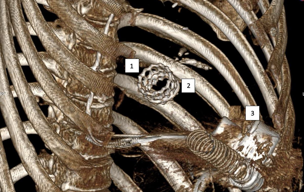 Figure 5 Refer to the following caption and surrounding text.